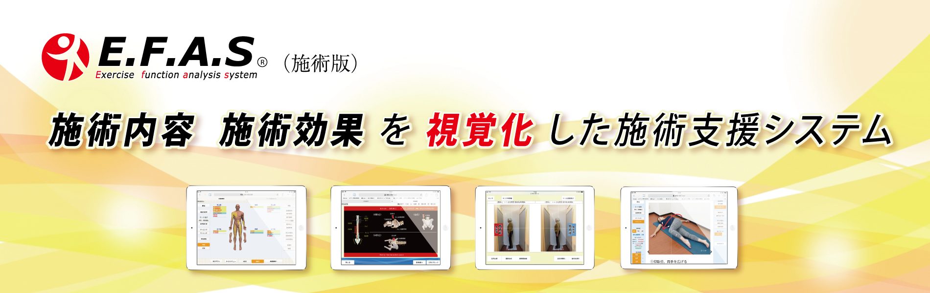 独自の整体技術　運動機能分析システム/姿勢検査/施術技術　整体院・整骨院・接骨院・リハビリなどで、腰椎ヘルニア/脊柱管狭窄症/五十肩/変形性膝関節症の早期改善と再発を予防します。運動分析は根本施術として利用される独自の施術方法です。アスリートや大学病院の医師も通われる整体技術です。自費移行や強化を目指す方は、イーファスにお任せください。